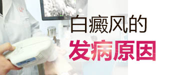 檢查白癜風(fēng)病因用什么方法