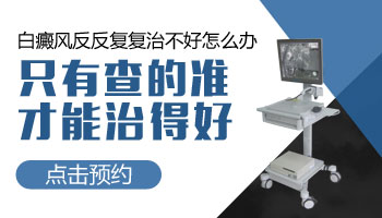 白癜風(fēng)