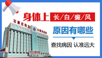 究竟是什么原因引起的白癜風(fēng)