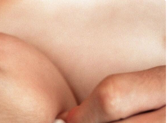 手臂患有白癜風(fēng)的四個(gè)月寶寶如何治療？