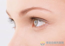 額頭皮膚發白沒有癢是不是白癜風