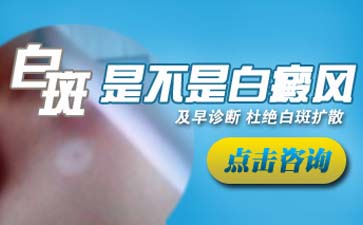白癜風(fēng)具體癥狀詳解