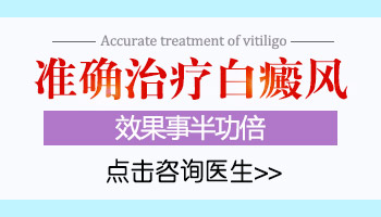 白斑在頭頂左側(cè)怎么治療好