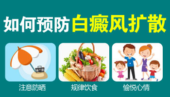 大腿上有一塊一塊的白斑擴散了怎么治