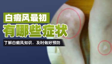 滄州有專業治療白癜風的醫院嗎