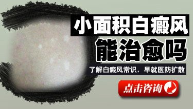 滄州白癜風醫院哪位專家治療白癜風好