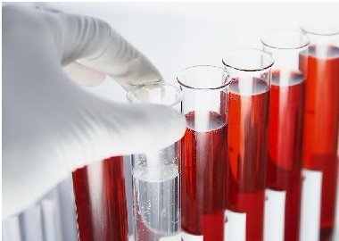 <a href=http://m.xvxgx.cn/ target=_blank class=infotextkey>石家莊白癜風醫(yī)院</a>青少年白癜風患者需要驗血嗎