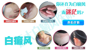 白癜風(fēng)類型.jpg