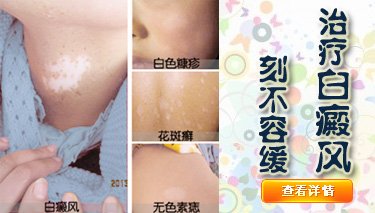 防止白癜風病情加重的方式是什么