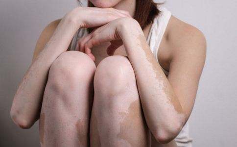 白癜風長期治不好越變越大怎樣能控制?