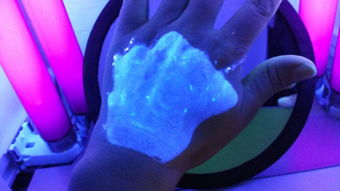 伍德燈檢查白斑說灰白色什么意思