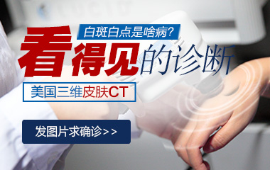 白癜風(fēng)初期在皮膚上有什么明顯的感覺(jué)