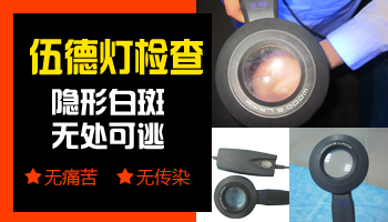 wood燈檢查白斑是不是白癜風準嗎