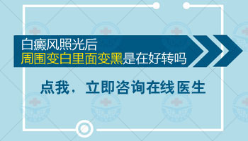 兒童白癜風(fēng).jpg