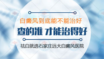兒童臉上長白斑白癜風怎么回事