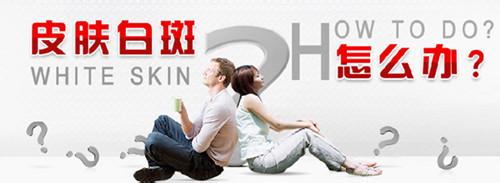 西醫治療孩子白癜風會不會復發