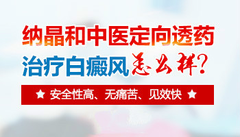 小孩臉上有一塊白癜風用什么方法治療快
