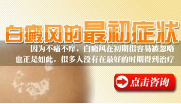 邯鄲白癜風早期一般是什么樣的