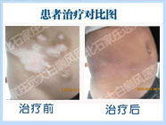 解下“白”腰帶,迎接新生活