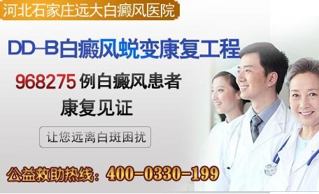 石家莊白癜風醫院：治療白癜風的新方法