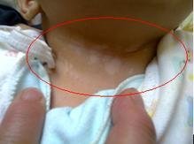 河北高邑看兒童白癜風好的專科白癜風醫院是哪個?