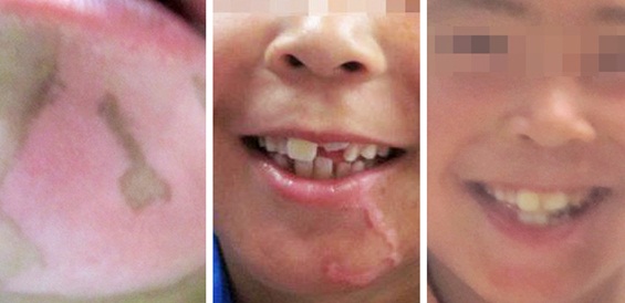 &ldquo;健康六一，快樂祛白&rdquo;大型兒童祛白診療援助活動啟動