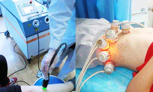  白癜風診療新技術推廣活動開啟