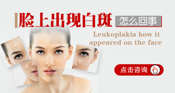 女性白癜風治療有什么要注意的
