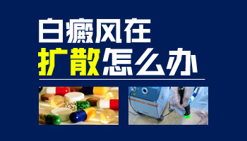 43歲女性白癜風吃什么能控制白斑擴散
