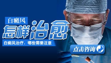 少年白癜風怎么治療好