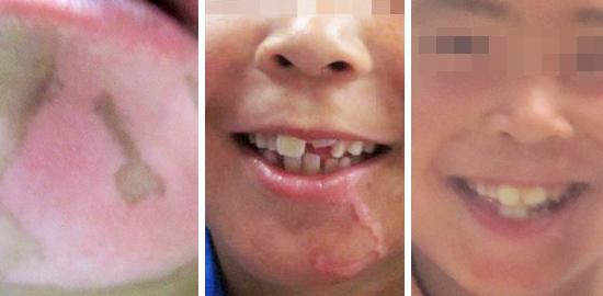 發(fā)現(xiàn)你長的不錯，可惜毀在了白癜風(fēng)