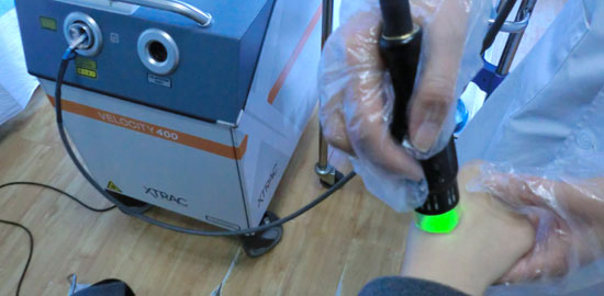 遠大十年  308nm激光祛白新升級