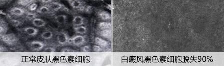 美國三維皮膚CT檢查免費