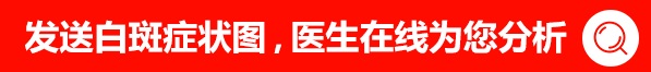 眼皮周圍有白癜風(fēng)308激光好嗎