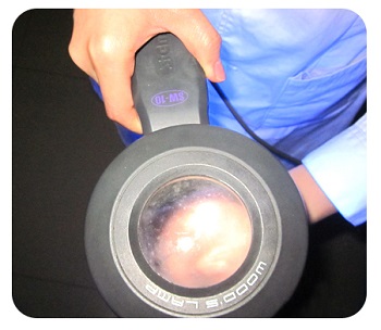 照燈時(shí)那個(gè)白癜風(fēng)的地方更白代表什么