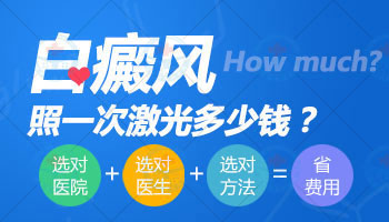 國產308治白斑是按照什么收費的