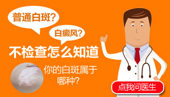白斑白點怎么判斷是不是白癜風