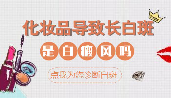 臉上有白癜風可以抹護膚品嗎