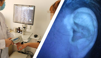 暑期白癜風診療補助活動開啟