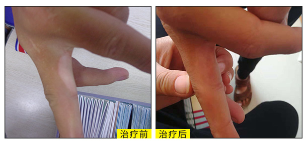 喜迎國慶，金秋送健康北京白癜風醫師大型會診援助活動啟動！