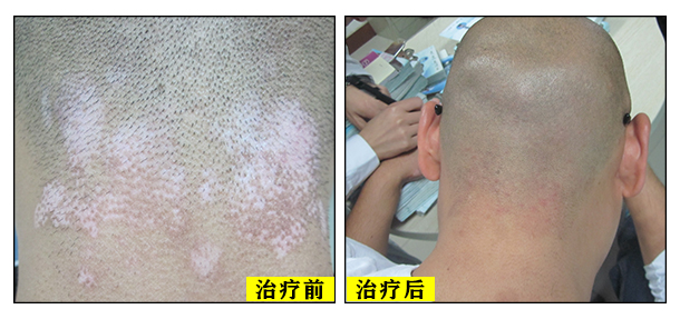 安心就醫·塑造專科典范——經驗醫生聯合坐診讓你安心就醫