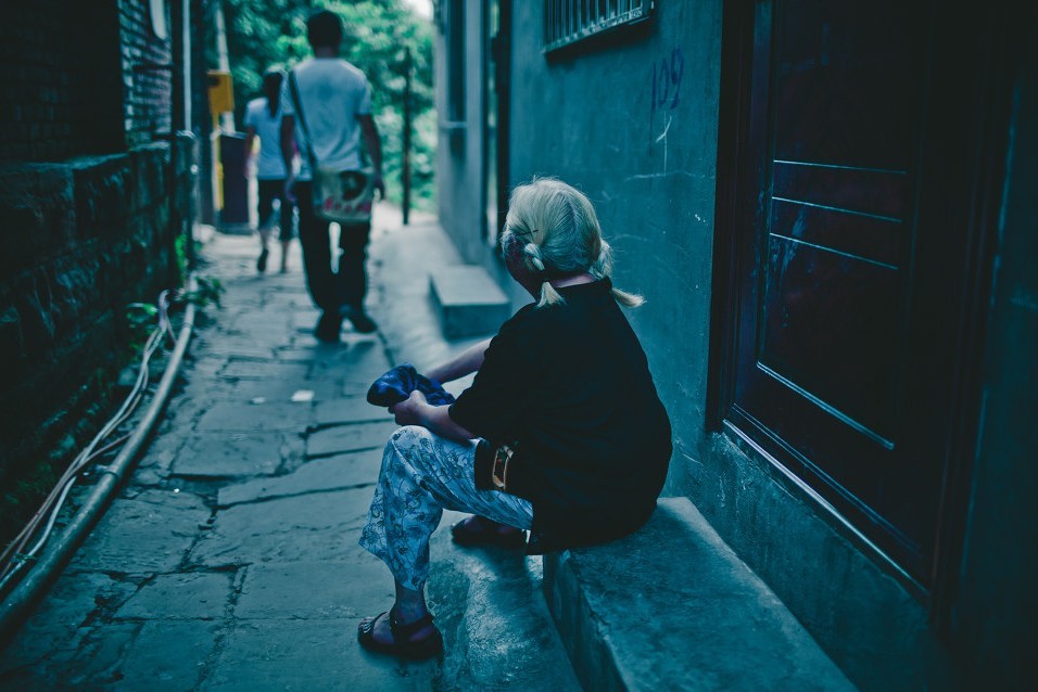 老年白斑和白癜風(fēng)區(qū)別是什么