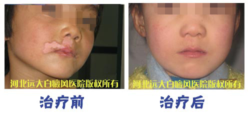 嘴唇表皮里有白點是怎么回事?