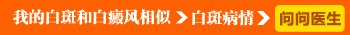 白癜風(fēng)