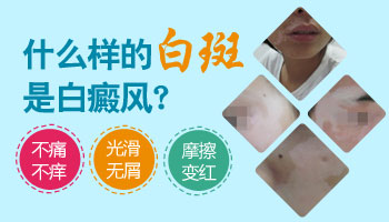 白了一塊會不會是白癜風(fēng)