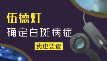 伍德燈能確診白斑是不是白癜風嗎