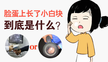 額頭突然白了一塊是怎么回事