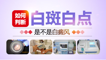 6歲寶寶額頭有白點怎么判斷是不是白癜風