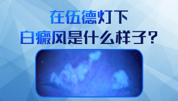 wood燈下白斑灰白色疑似是白癜風怎么辦