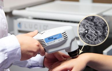 ct檢測(cè)白斑是不是白癜風(fēng)的準(zhǔn)確率是多少